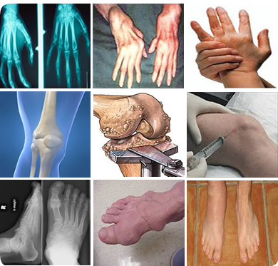 Rheumatology Services